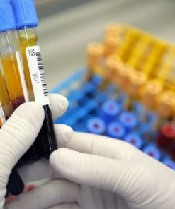 BORDETELLA PERTUSSIS IGG - QUANTITATIVE