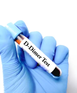 D-DIMER PROFILE