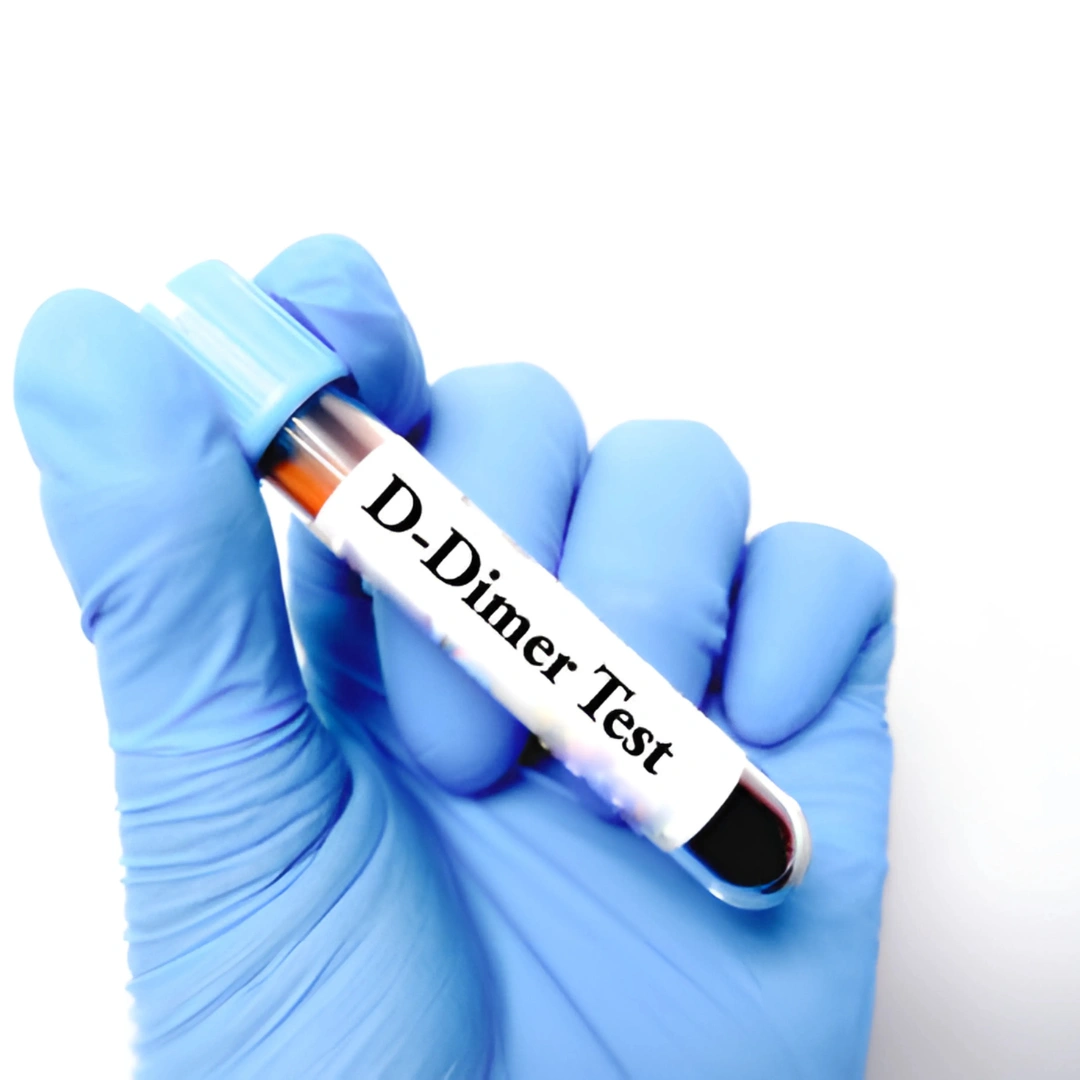 D-DIMER PROFILE