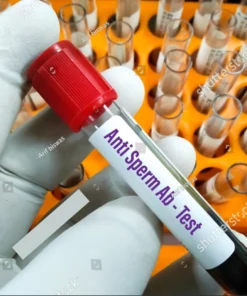 ANTI SPERM ANTIBODIES, SERUM