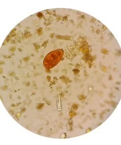 Stool Routine Examination