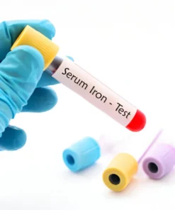 Iron, Serum