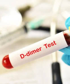 D-DIMER; SEMI QUANTITATIVE