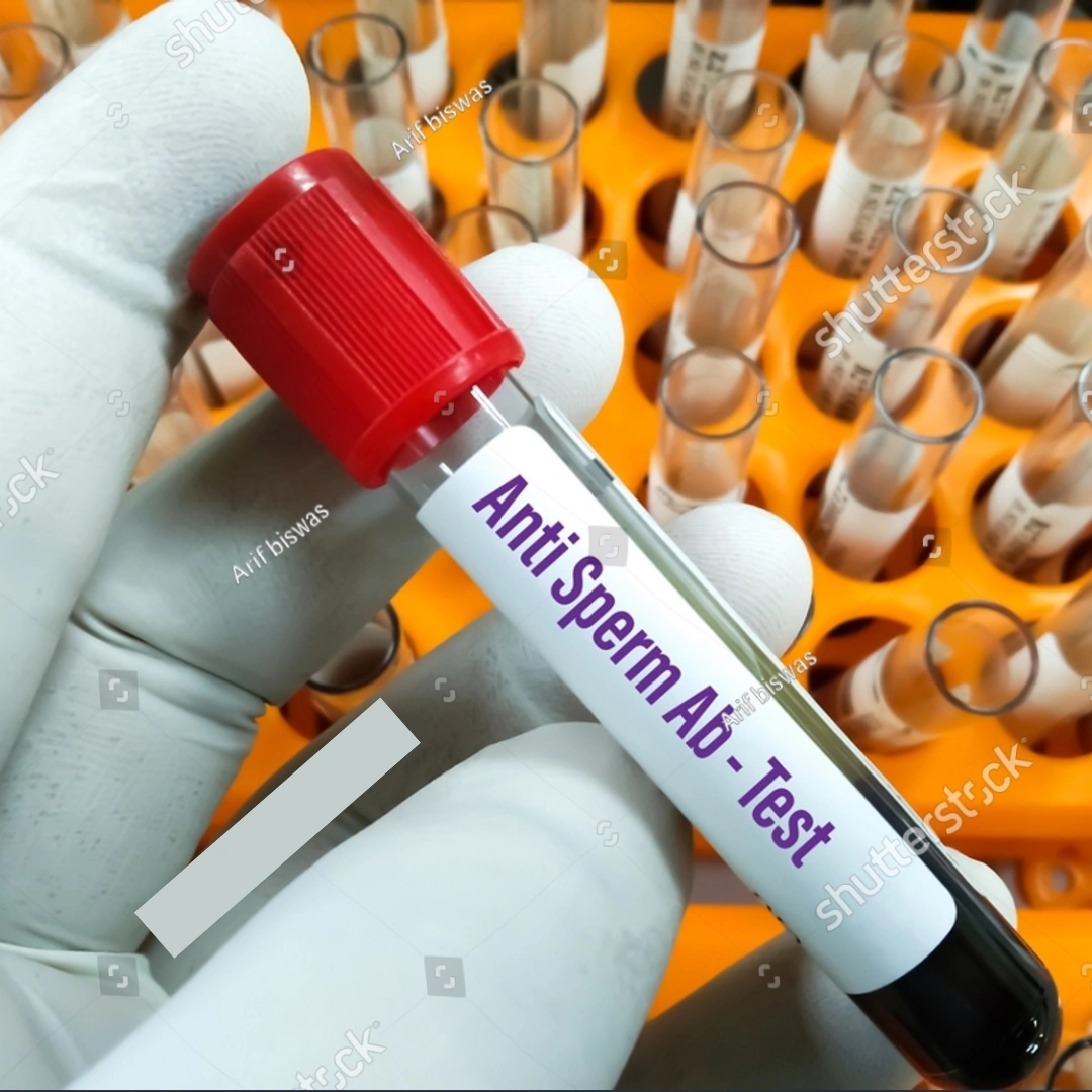 ANTI STREPTOLYSIN O (QUALITATIVE),SERUM