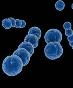 Streptococcus Group B Antigen Detection