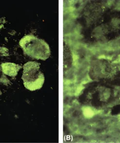 Islet Cell Antibody Screen