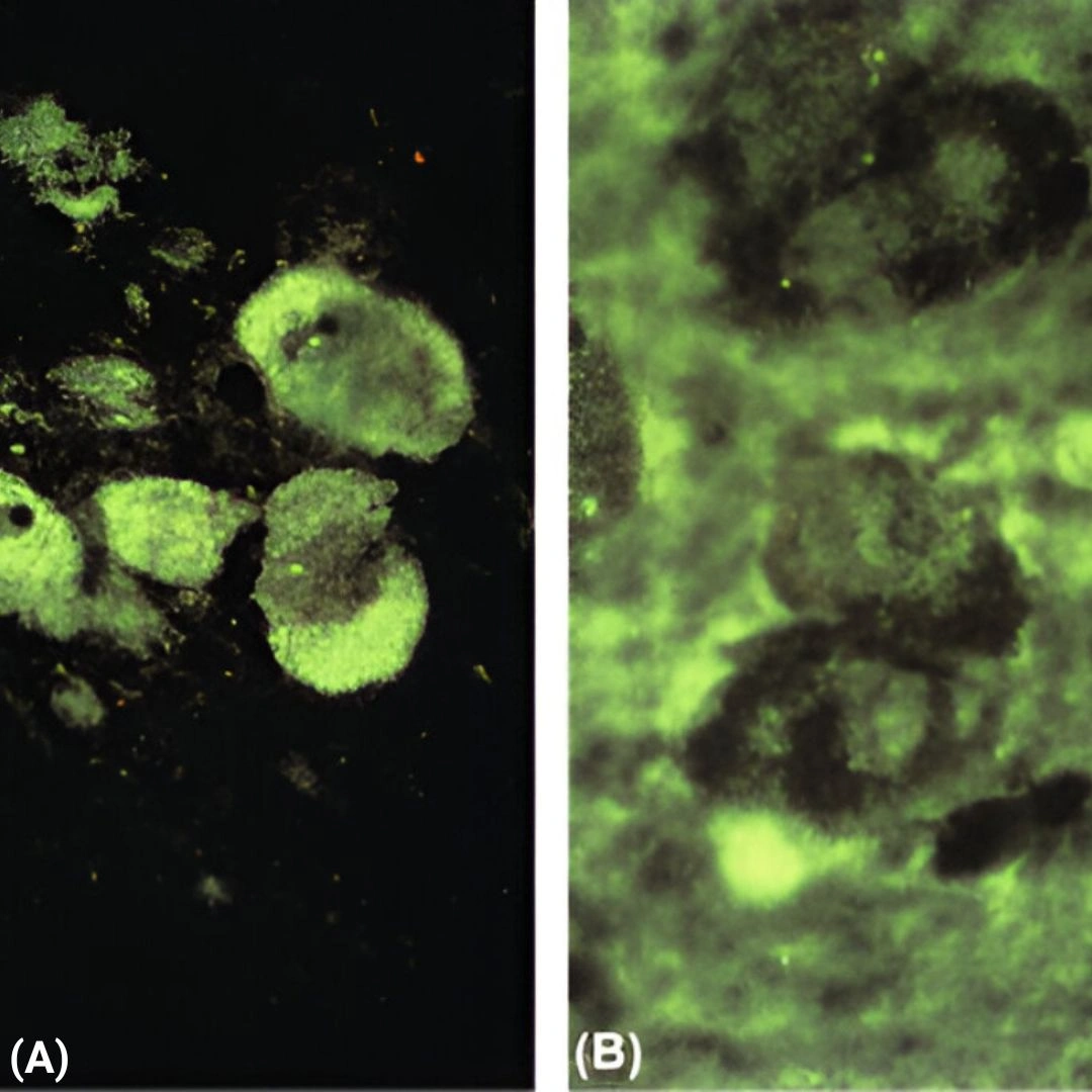 Islet Cell Antibody Screen