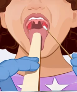 Swab Culture (Miscellaneous)