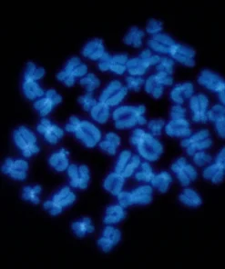 DELETION 17P, P53 (M MYE- LOMA, CLL) LEUKEMIC FISH