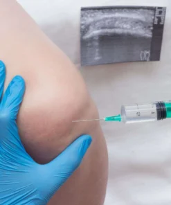 Synovial Fluid , Routine Examination