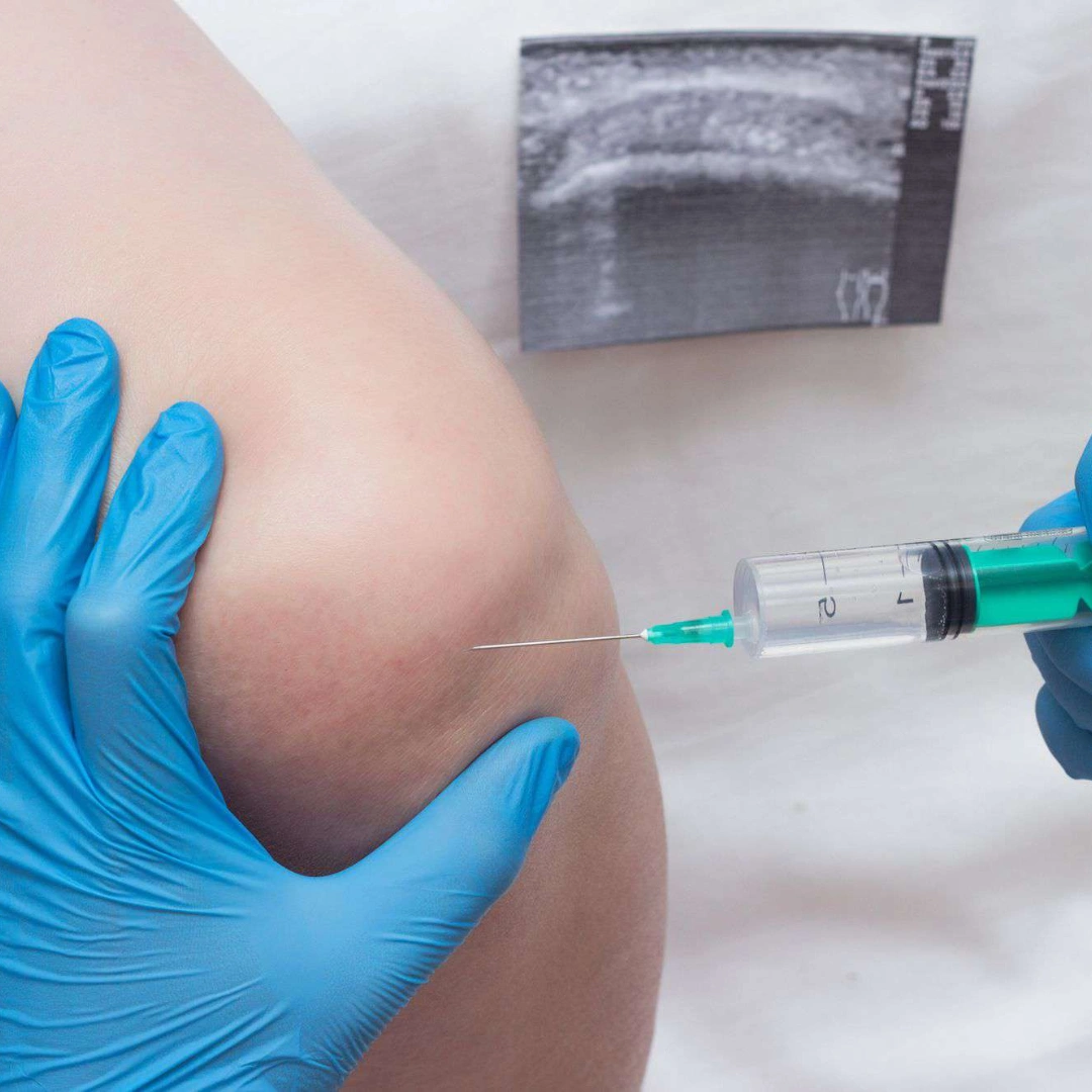 Synovial Fluid , Routine Examination