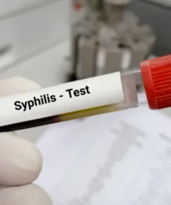 Syphilis Antibodies