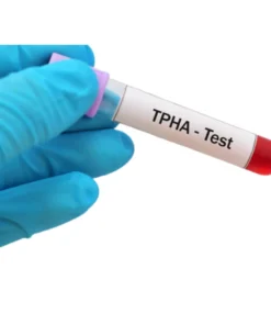 TPHA (TREPONEMA PALLIDUM) HAEMAGGLUTINATION,SERUM