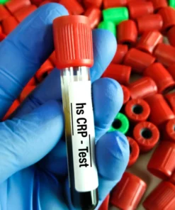 High Sensitive C-Reactive Protein(Hs_Crp), Serum