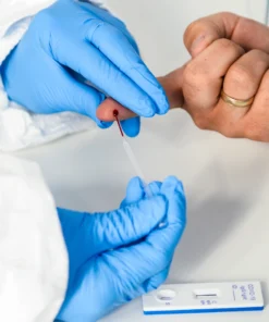 TOXOPLASMA IGM, SERUM