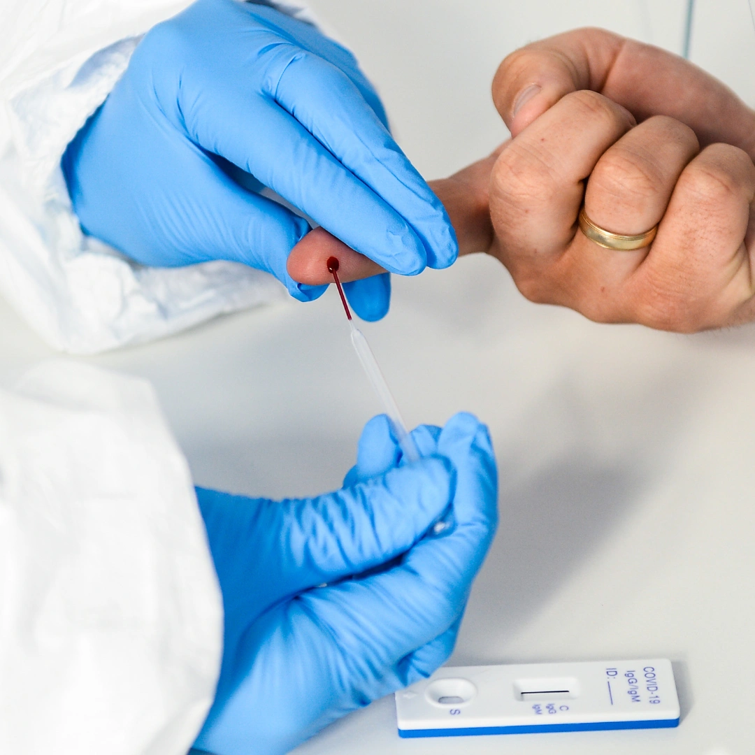 TOXOPLASMA IGM, SERUM