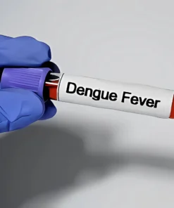 DENGUE IGG ANTIBODIES, SERUM