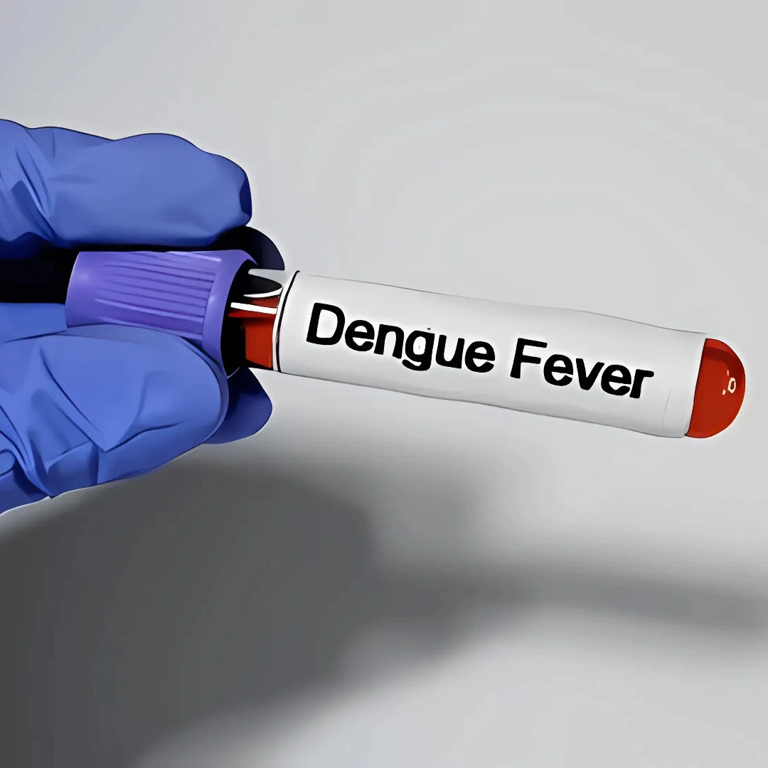 DENGUE IGG ANTIBODIES, SERUM