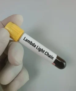 Kappa/Lambda Light Chains (Free)