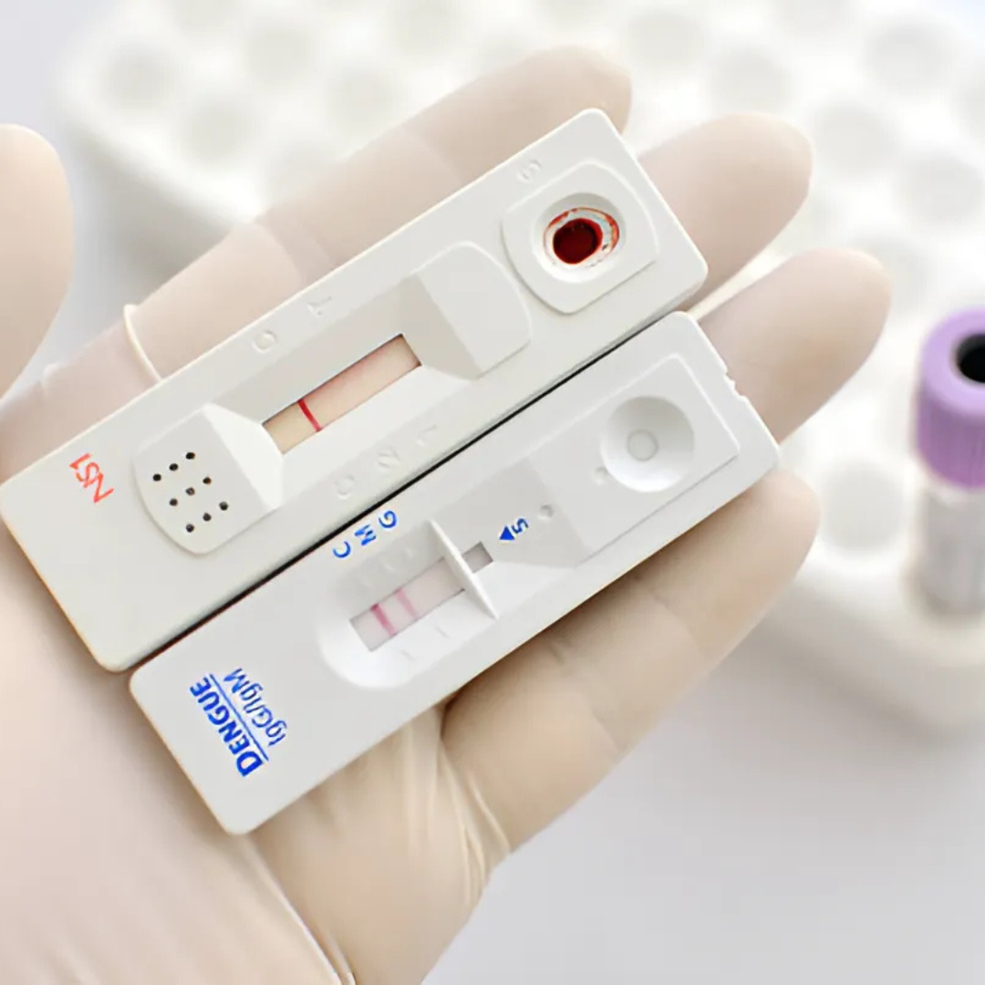 DENGUE NS1 ANTIGEN, RAPID, SERUM