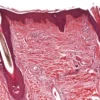 Histopathological Examination Of Skin Biopsy