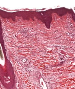 Histopathological Examination Of Skin Biopsy