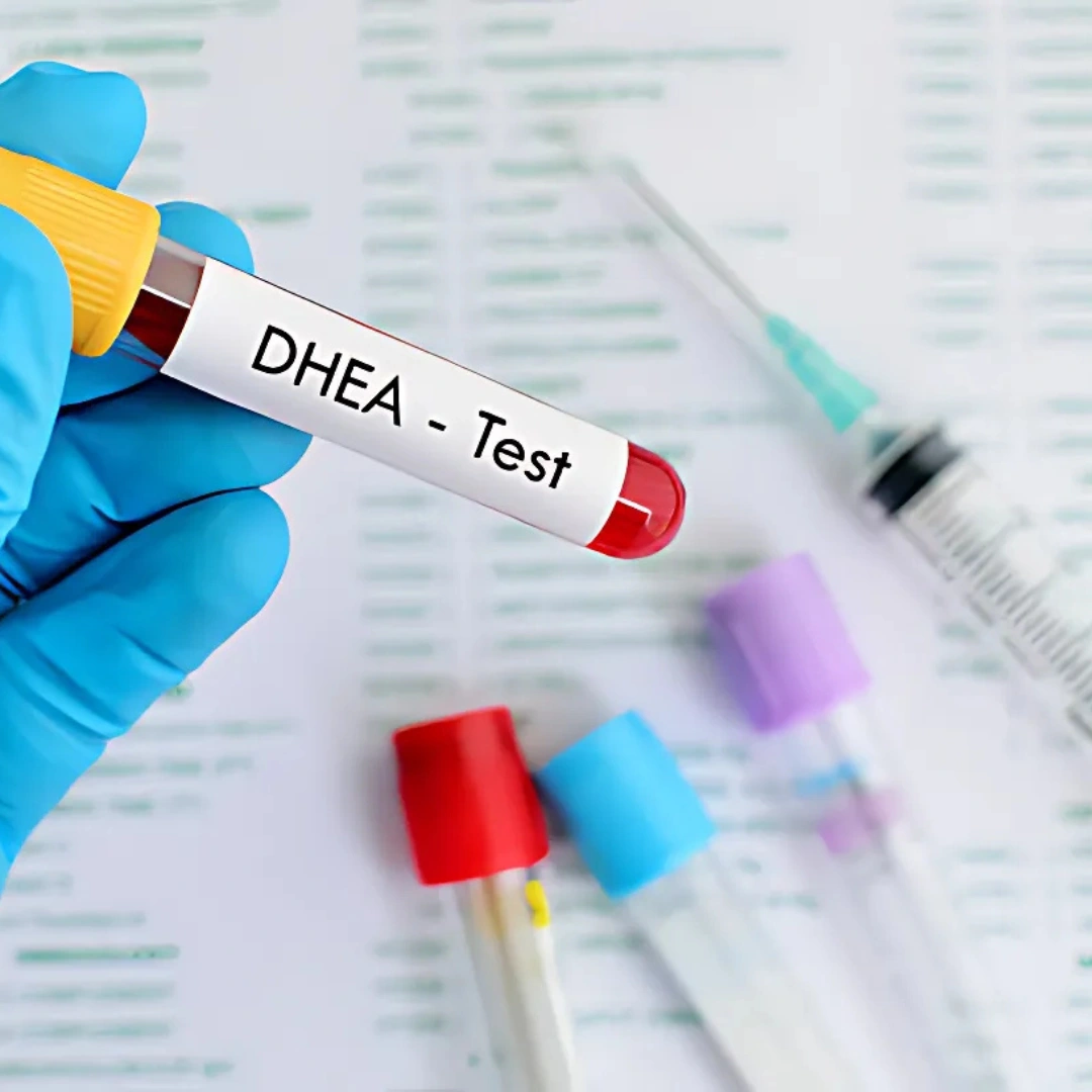 DHEA-SULPHATE, SERUM