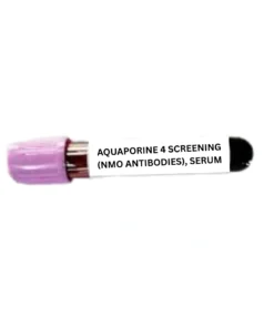 AQUAPORINE 4 SCREENING (NMO ANTIBODIES), SERUM