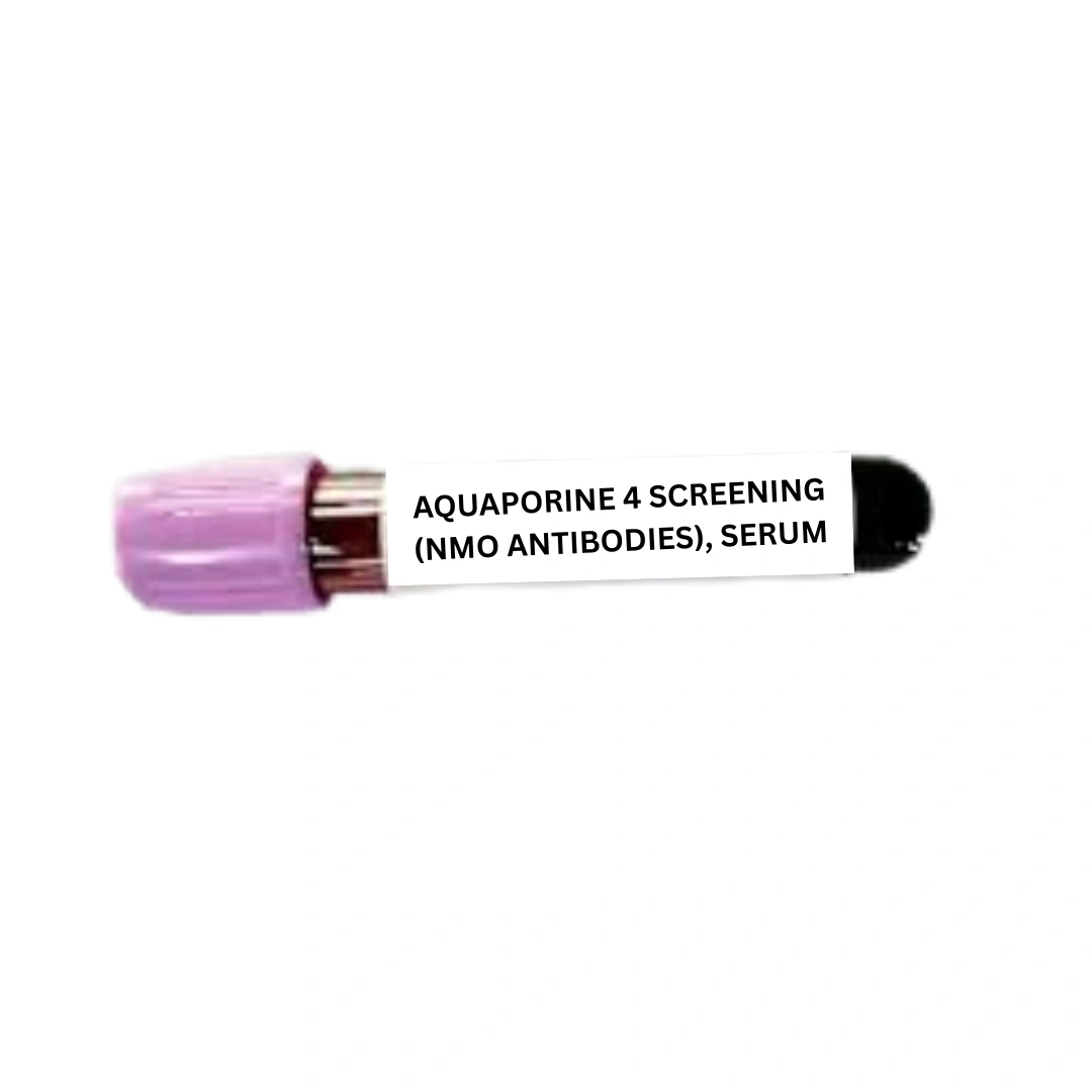 AQUAPORINE 4 SCREENING (NMO ANTIBODIES), SERUM