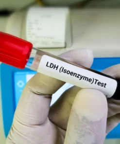 Lactate Dehydrogenase (Ldh), Fluid