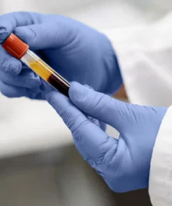 Hiv Detection (Qualitative) Test