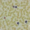 Lap (Leucocyte Alkaline Phosphatase/Neutro- Phil Alk