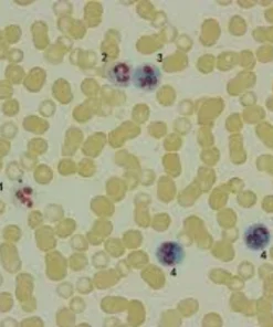Lap (Leucocyte Alkaline Phosphatase/Neutro- Phil Alk
