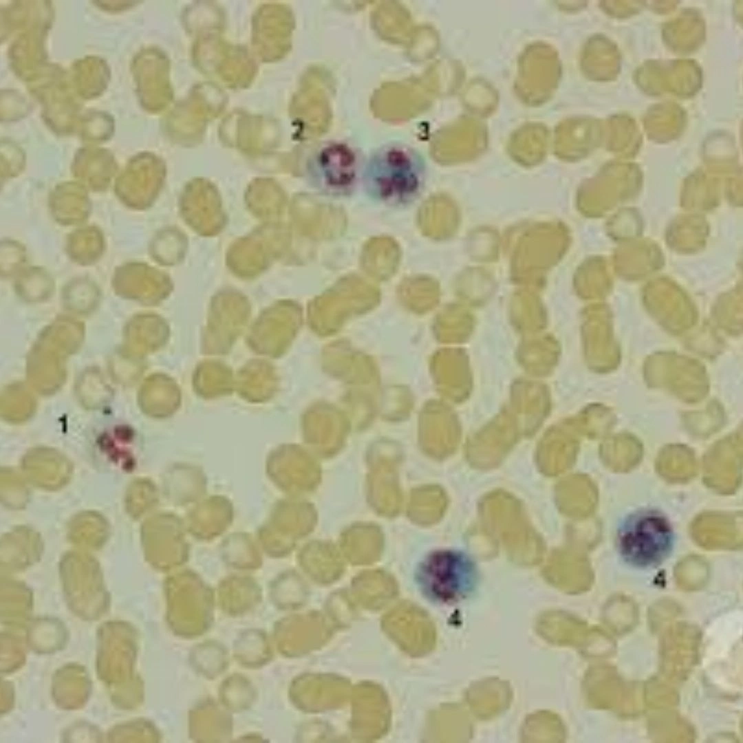 Lap (Leucocyte Alkaline Phosphatase/Neutro- Phil Alk