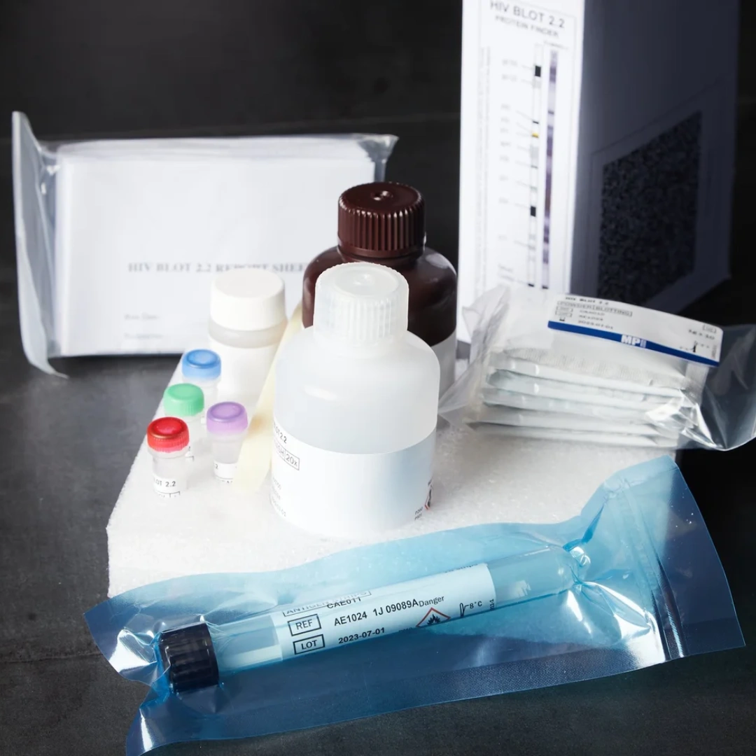 Hiv Western Blot Assay, Serum