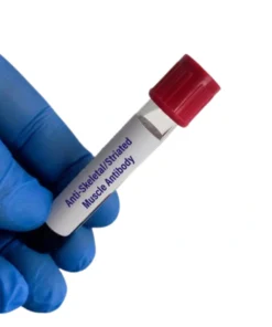 ASKA (STRIATED) MUSCLE ANTIBODY