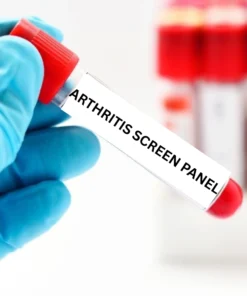 ARTHRITIS SCREEN PANEL
