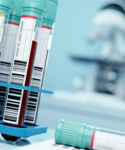 Hiv-2 Rna Detection By Real Time Pcr