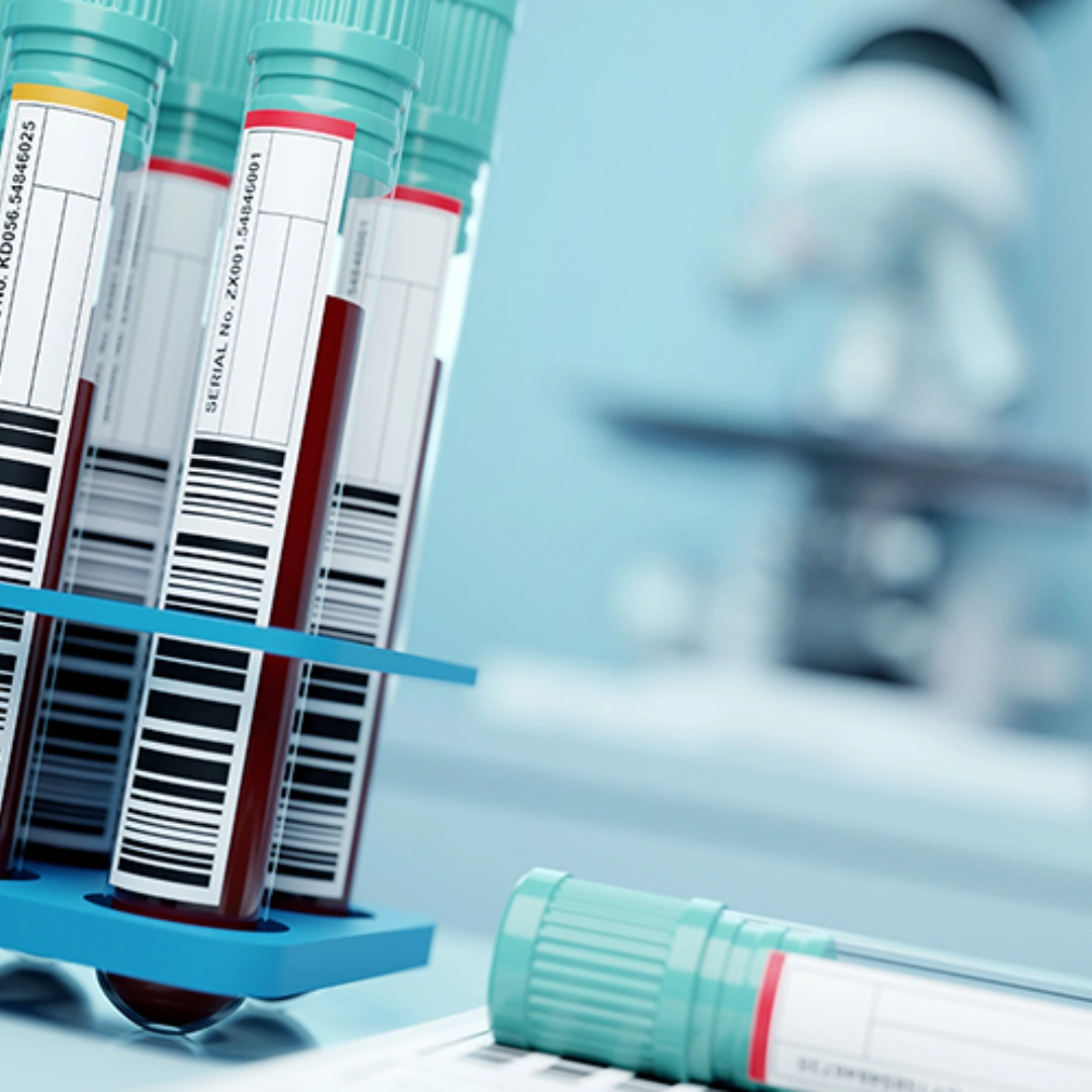 Hiv-2 Rna Detection By Real Time Pcr