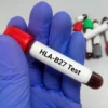 Hla B27, Whole Blood*