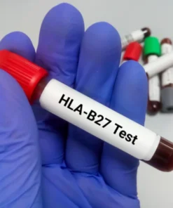 Hla B27, Whole Blood*