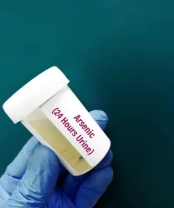 ARSENIC, URINE RANDOM