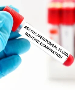 ASCITIC/PERITONEAL FLUID, ROUTINE EXAMINATION