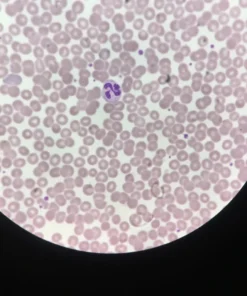 DIFFERENTIAL LEUKOCYTE COUNT, WHOLE BLOOD