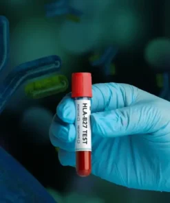 Hla-B27 Detection Test