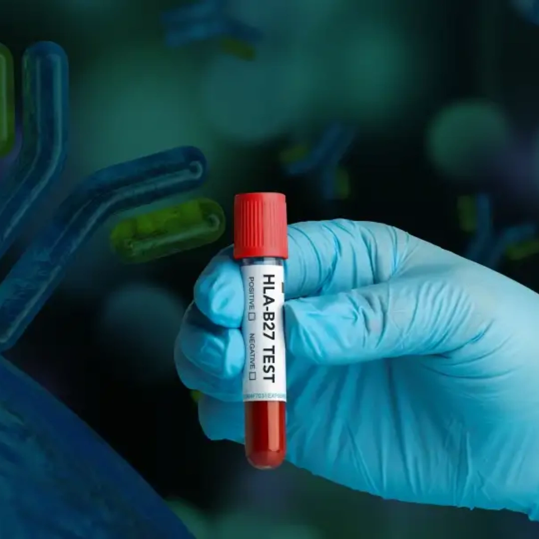 Hla-B27 Detection Test