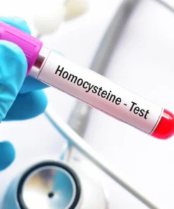 Homocysteine, Serum