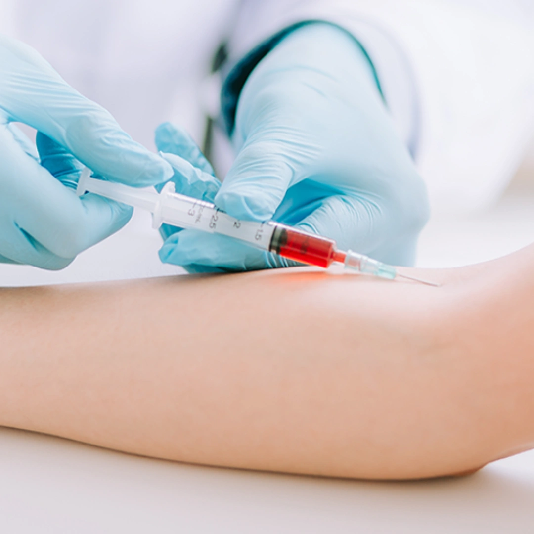 ALLERGY COMPREHENSIVE (FOOD+INHALANT+NON VEG+DRUG)