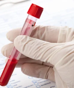 Leptospira Antibody (Igg & Igm), Serum