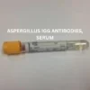 ASPERGILLUS IGG ANTIBODIES, SERUM
